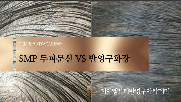 SMP 두피문신 VS 반영구화장1